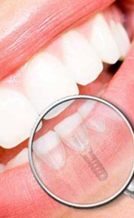 دانتوں کا علاج