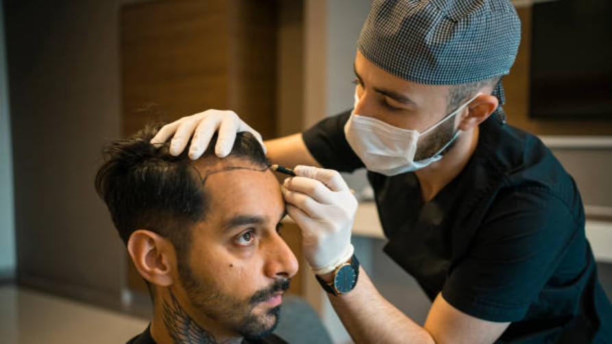 What is DHI Hair Transplantation?
