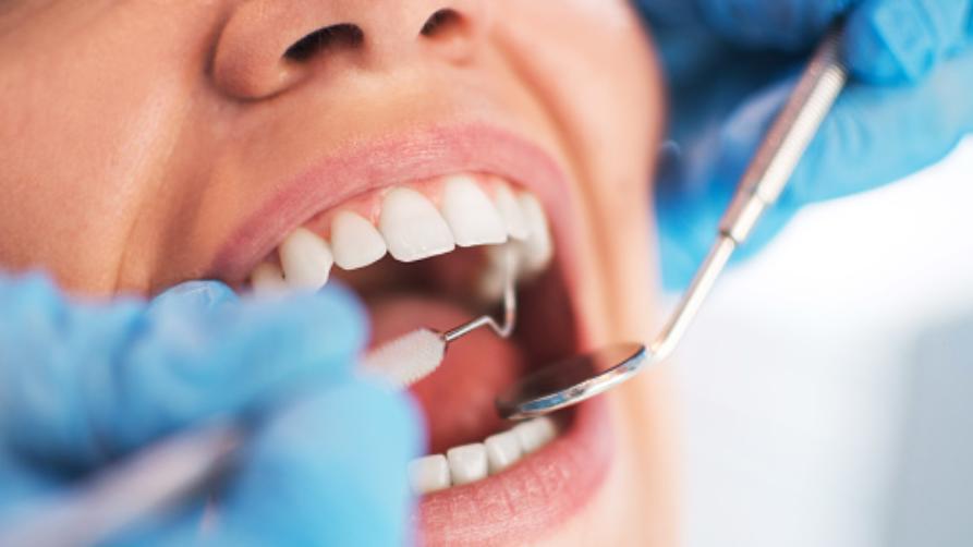 トルコでの歯冠の処置とアフターケア