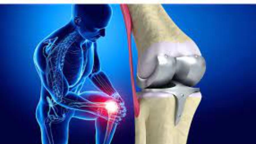 Какво е смяна на колянна става?