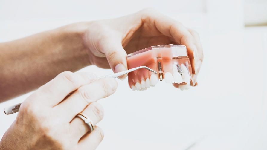Os mellores centros de implantes e implantes dentais de Turquía