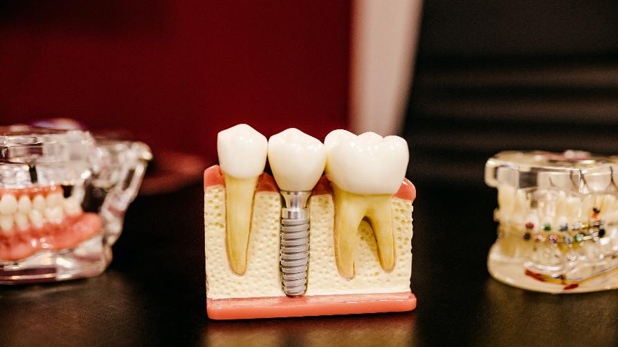 Les millors ciutats per tenir un implant dental a Turquia