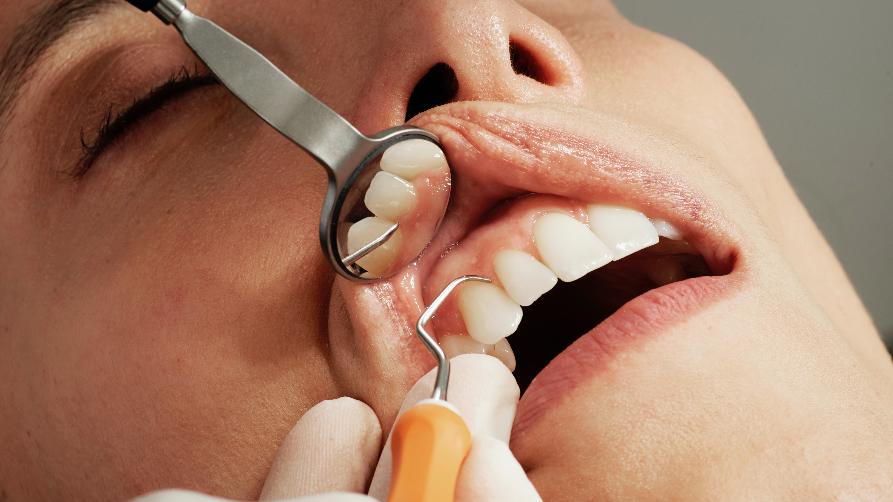 É seguro viaxar a Turquía para conseguir implantes dentais?
