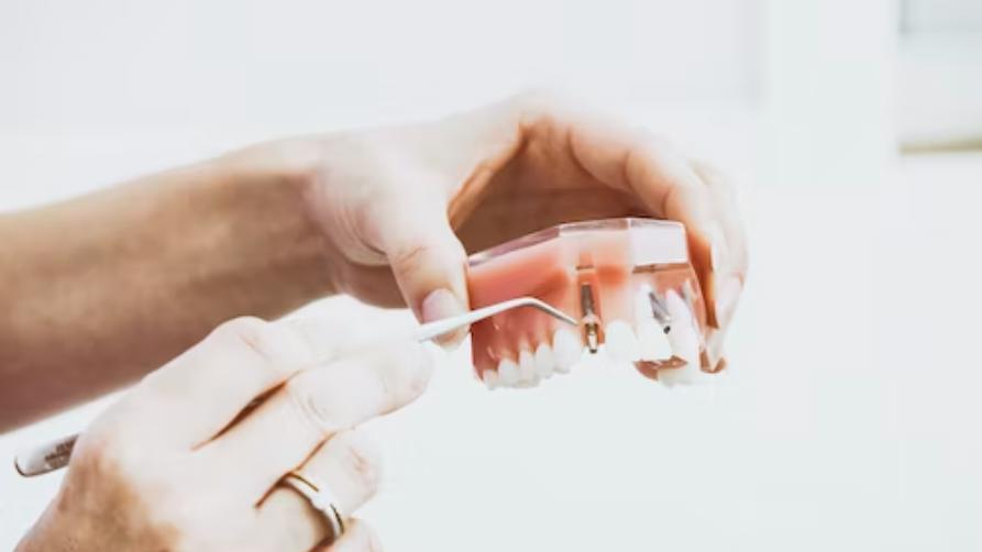 Implants dental ongkos low di Turki