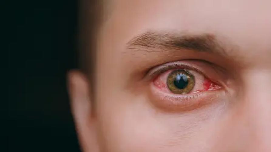 Transformació dels ulls: tractaments de queratopigmentació a Turquia
