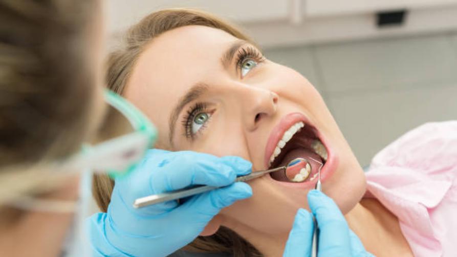Любопитни за зъбните фасети