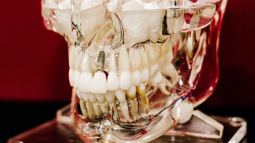 Чудові варіанти лікування зубів у Стамбулі Бешикташ!