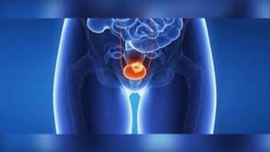 Рак на простатата